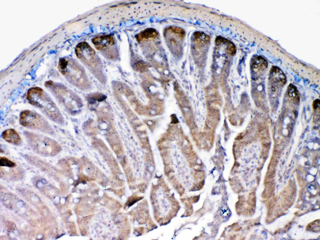 MMP13 Antibody in Immunohistochemistry (Paraffin) (IHC (P))