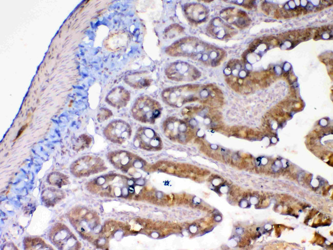 MMP13 Antibody in Immunohistochemistry (Paraffin) (IHC (P))