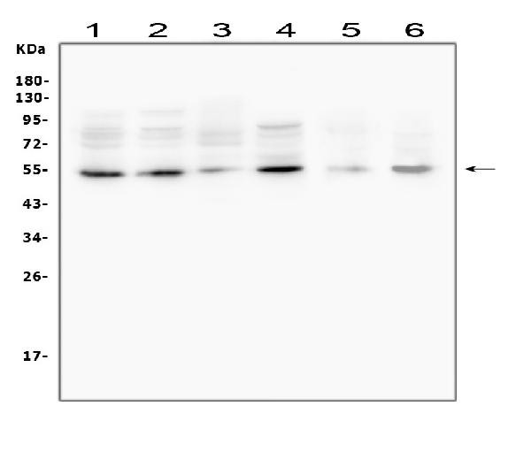 MMP13 Antibody in Western Blot (WB)