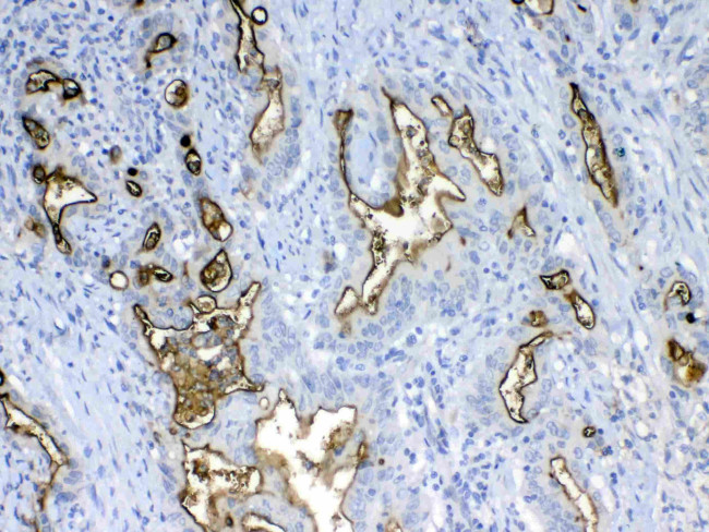 MUC1 Antibody in Immunohistochemistry (Paraffin) (IHC (P))