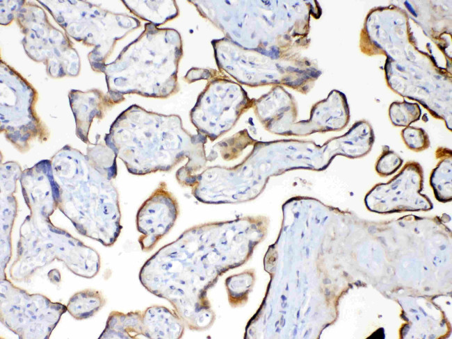 MUC1 Antibody in Immunohistochemistry (Paraffin) (IHC (P))