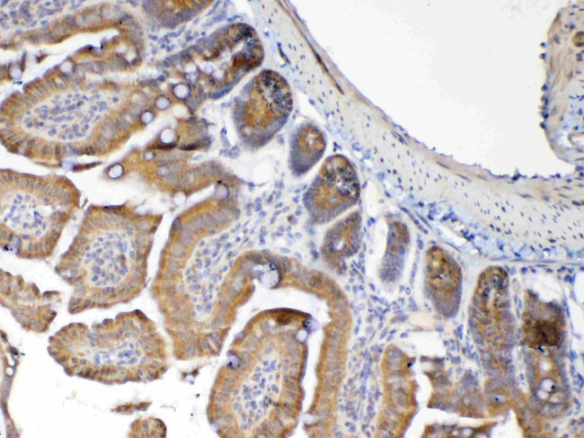 MUC1 Antibody in Immunohistochemistry (Paraffin) (IHC (P))