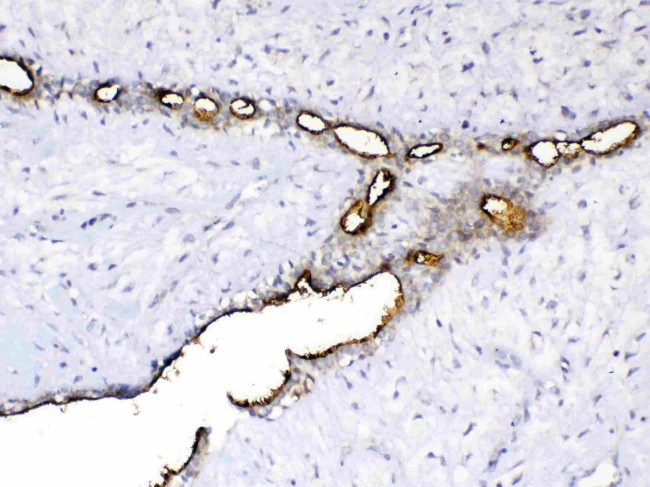 MUC1 Antibody in Immunohistochemistry (Paraffin) (IHC (P))