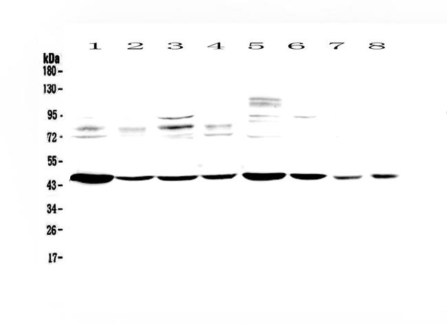 PDK2 Antibody in Western Blot (WB)