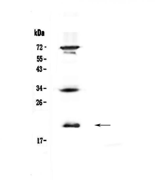 IL17B Antibody in Western Blot (WB)