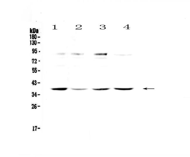 OGG1 Antibody in Western Blot (WB)