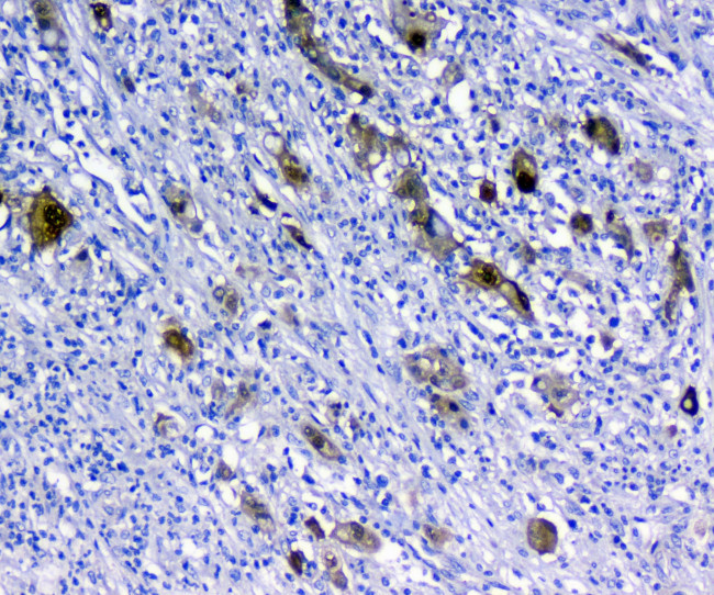 14-3-3 sigma Antibody in Immunohistochemistry (Paraffin) (IHC (P))