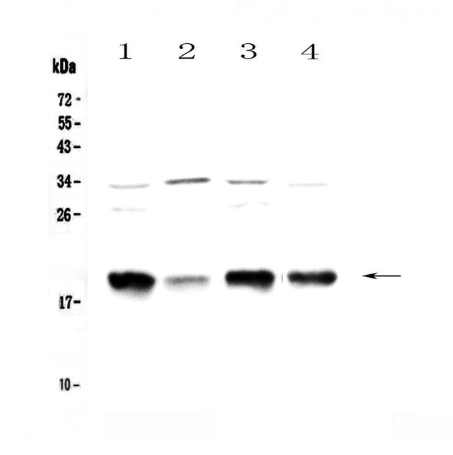 Galanin Antibody in Western Blot (WB)