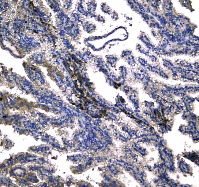 NOX4 Antibody in Immunohistochemistry (Paraffin) (IHC (P))