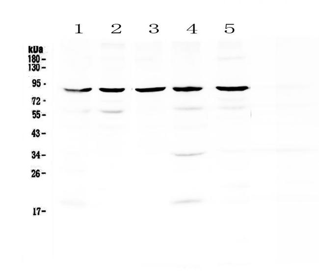 NOX4 Antibody in Western Blot (WB)