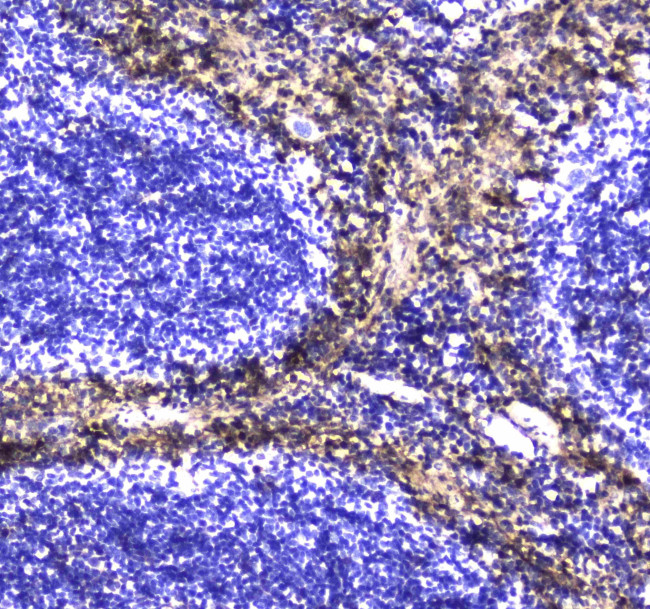 S100A10 Antibody in Immunohistochemistry (Paraffin) (IHC (P))