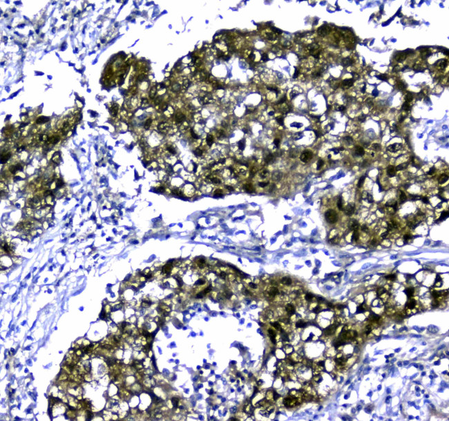 STUB1 Antibody in Immunohistochemistry (Paraffin) (IHC (P))