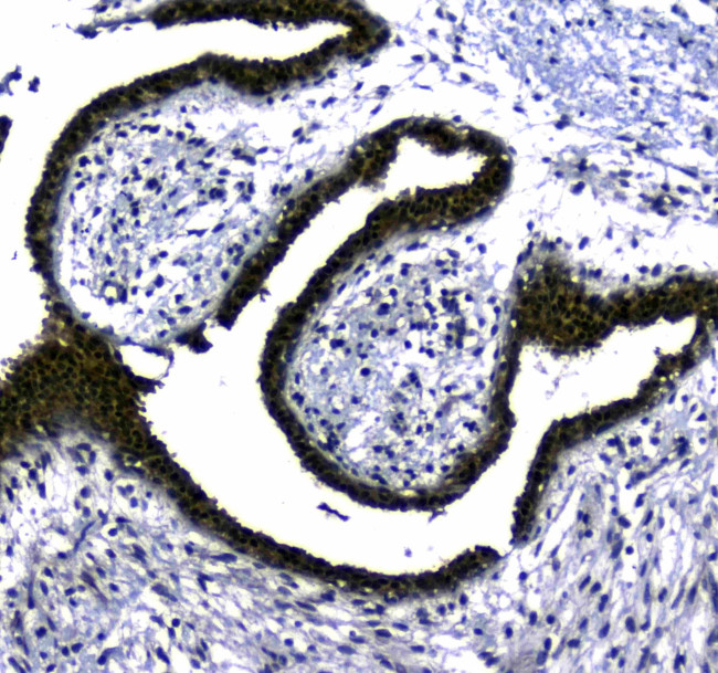 STUB1 Antibody in Immunohistochemistry (Paraffin) (IHC (P))