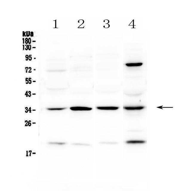 STUB1 Antibody in Western Blot (WB)