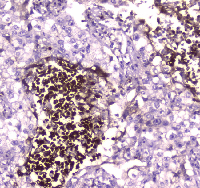 Lactoferrin Antibody in Immunohistochemistry (Paraffin) (IHC (P))