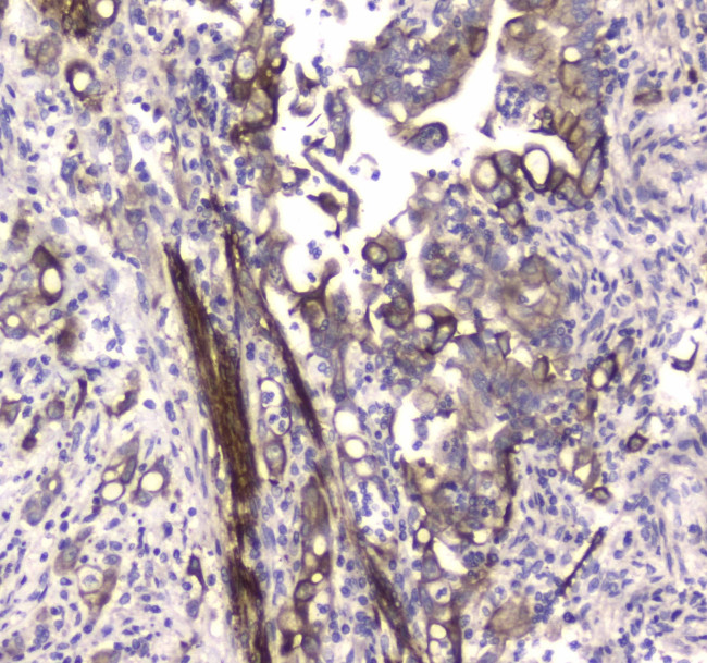 LC3A Antibody in Immunohistochemistry (Paraffin) (IHC (P))