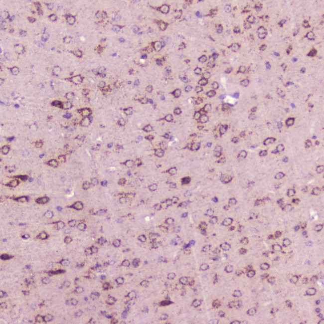 Calcitonin Antibody in Immunohistochemistry (Paraffin) (IHC (P))