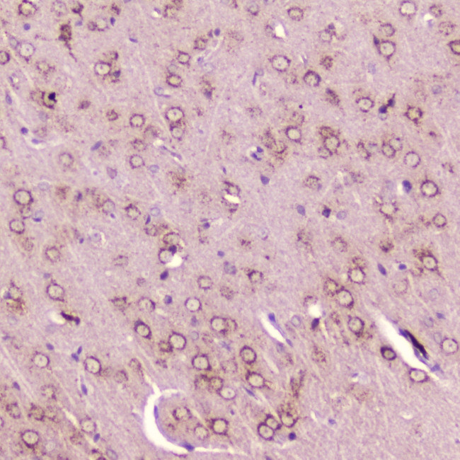 Calcitonin Antibody in Immunohistochemistry (Paraffin) (IHC (P))