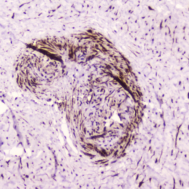 PDGFRB Antibody in Immunohistochemistry (Paraffin) (IHC (P))