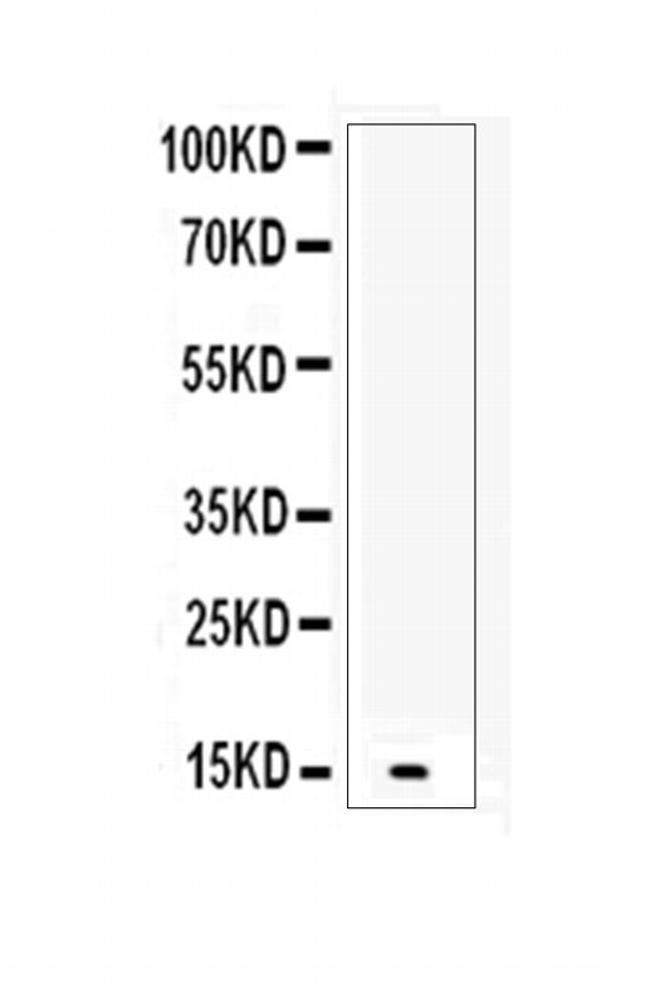 betacellulin Antibody in Western Blot (WB)