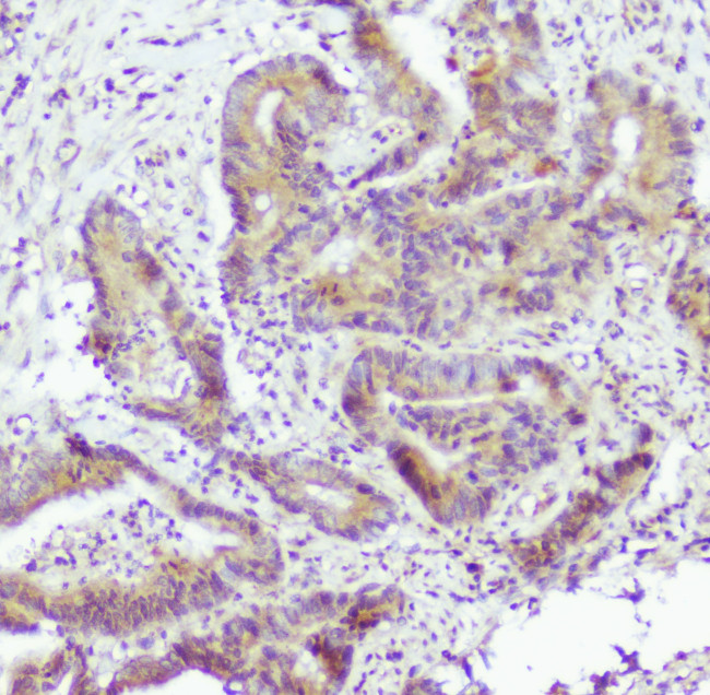 Caspase 2 Antibody in Immunohistochemistry (Paraffin) (IHC (P))