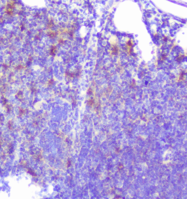 Caspase 2 Antibody in Immunohistochemistry (Paraffin) (IHC (P))