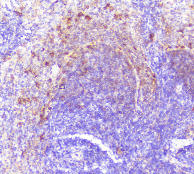 Caspase 2 Antibody in Immunohistochemistry (Paraffin) (IHC (P))