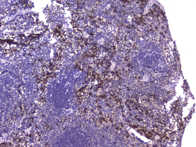 MCP-2 Antibody in Immunohistochemistry (Paraffin) (IHC (P))