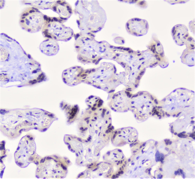 Properdin Antibody in Immunohistochemistry (Paraffin) (IHC (P))