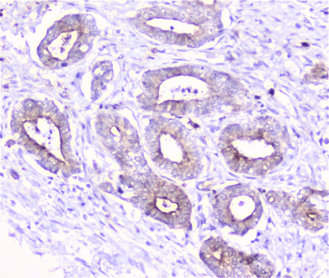 COMP Antibody in Immunohistochemistry (Paraffin) (IHC (P))