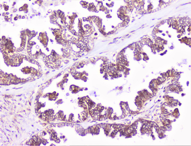 COMP Antibody in Immunohistochemistry (Paraffin) (IHC (P))