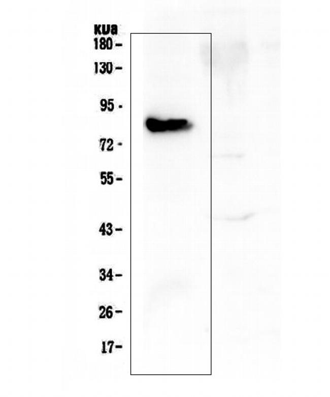 COMP Antibody in Western Blot (WB)