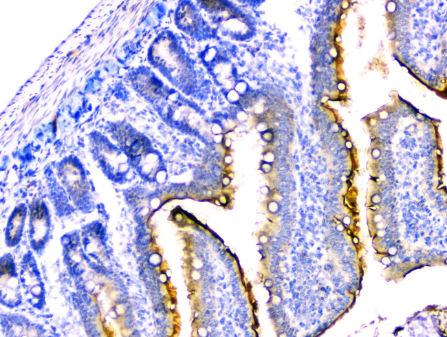 DDR2 Antibody in Immunohistochemistry (Paraffin) (IHC (P))