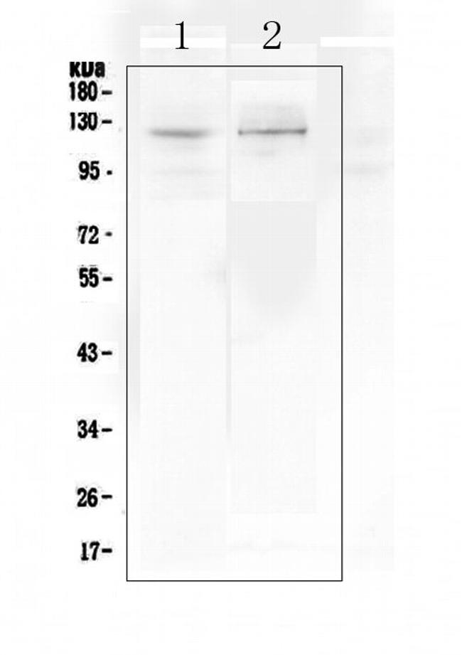 DDR2 Antibody in Western Blot (WB)