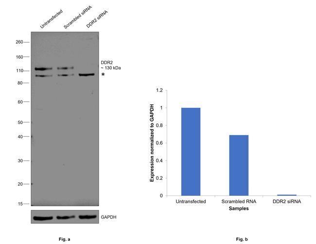 DDR2 Antibody in Western Blot (WB)