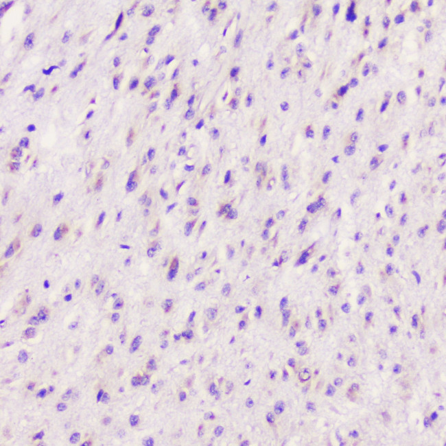 ELAVL2 Antibody in Immunohistochemistry (Paraffin) (IHC (P))