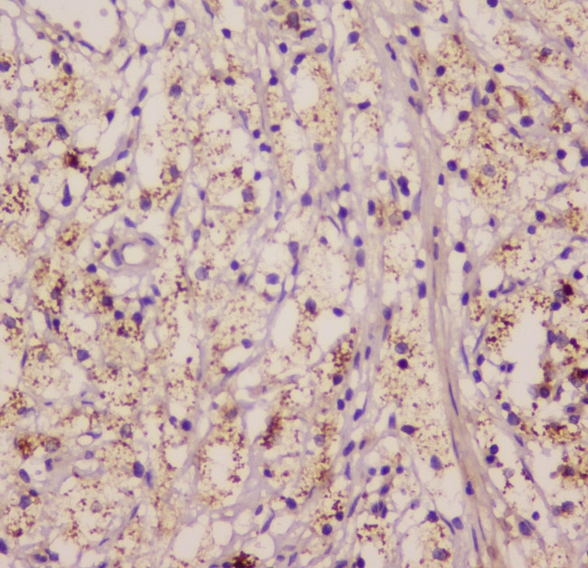 EML4 Antibody in Immunohistochemistry (Paraffin) (IHC (P))