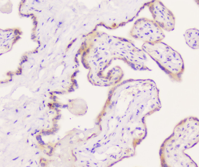 EML4 Antibody in Immunohistochemistry (Paraffin) (IHC (P))