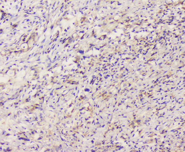 EML4 Antibody in Immunohistochemistry (Paraffin) (IHC (P))