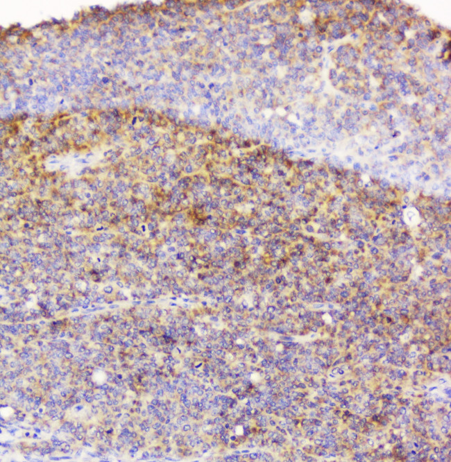 EML4 Antibody in Immunohistochemistry (Paraffin) (IHC (P))