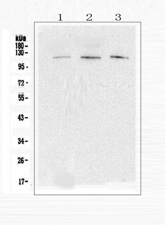 EML4 Antibody in Western Blot (WB)