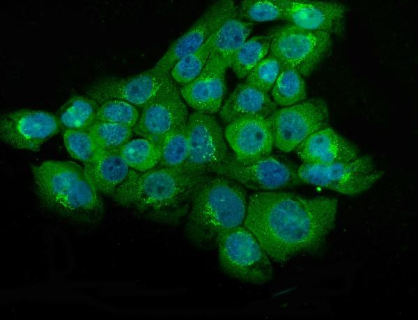 NSE Antibody in Immunocytochemistry (ICC/IF)