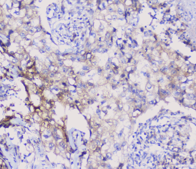 NSE Antibody in Immunohistochemistry (Paraffin) (IHC (P))