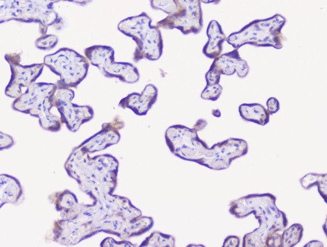 NSE Antibody in Immunohistochemistry (Paraffin) (IHC (P))