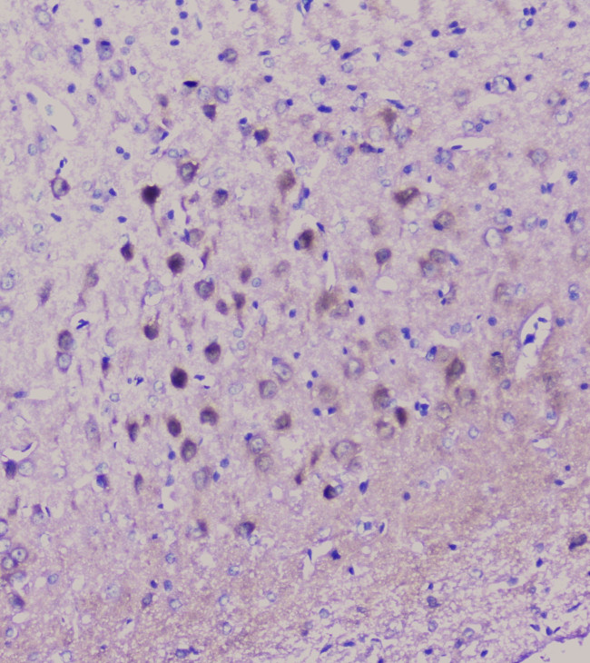 NSE Antibody in Immunohistochemistry (Paraffin) (IHC (P))