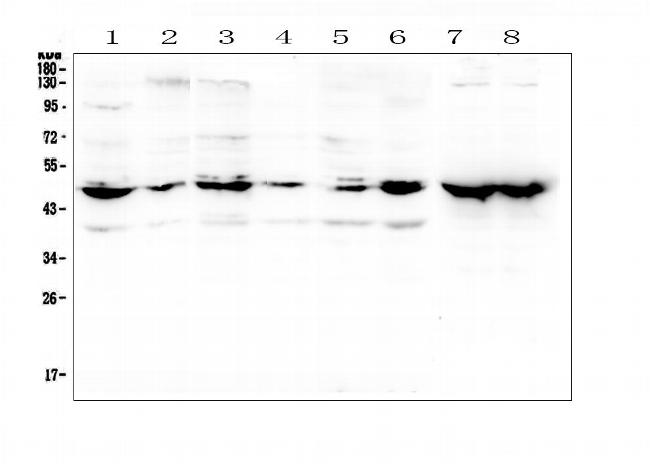 NSE Antibody in Western Blot (WB)