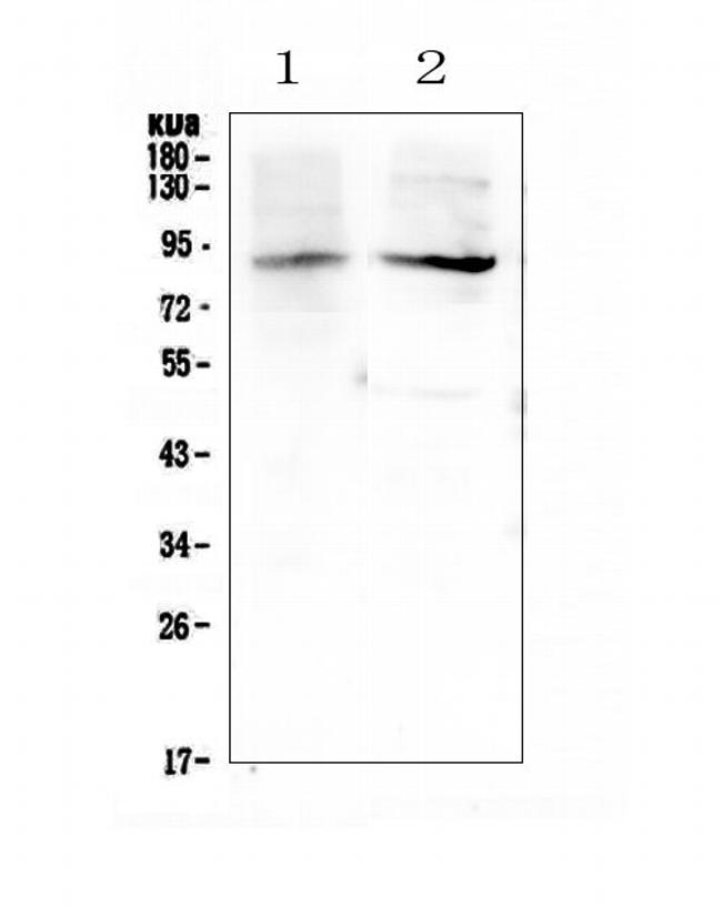 XPB Antibody in Western Blot (WB)