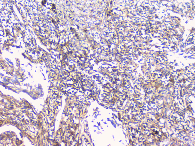 FCGR2A Antibody in Immunohistochemistry (Paraffin) (IHC (P))