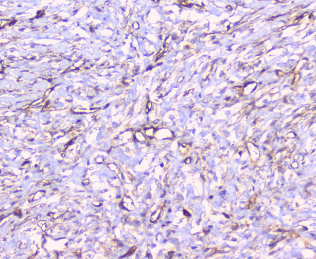 FCGR2A Antibody in Immunohistochemistry (Paraffin) (IHC (P))