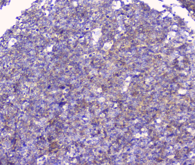 FCGR2A Antibody in Immunohistochemistry (Paraffin) (IHC (P))